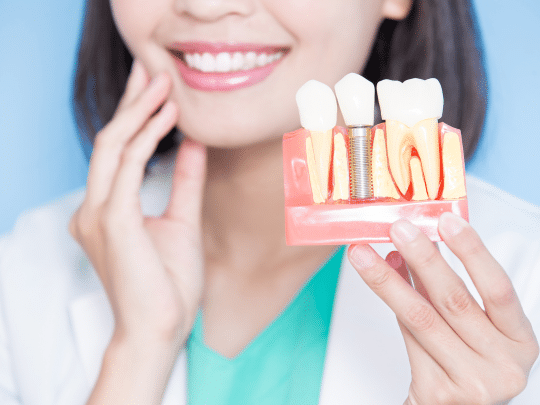 Shreveport Dental Implants Your Perfect Smile Journey