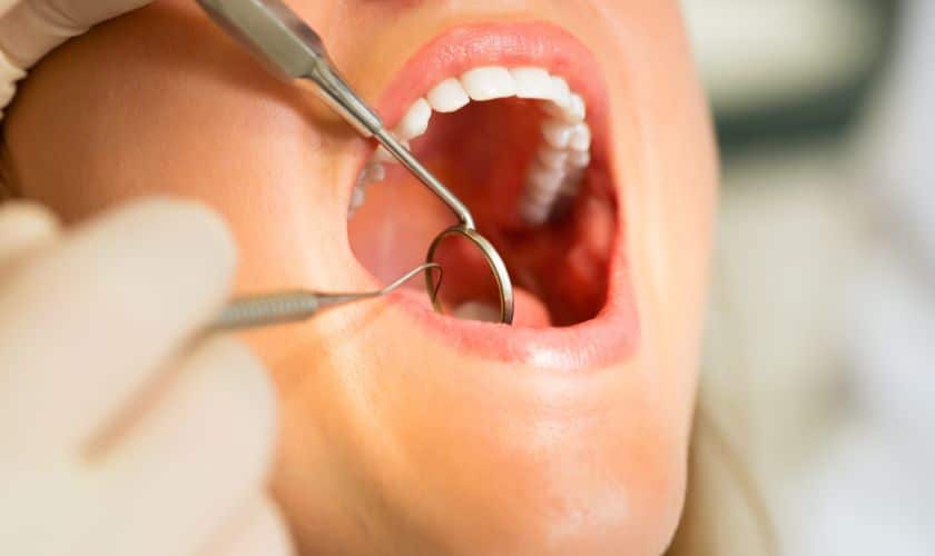 Dental Implants Shreveport