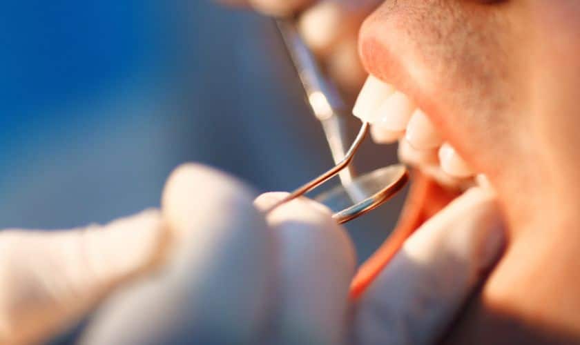 Routine Dental Care in Shreveport