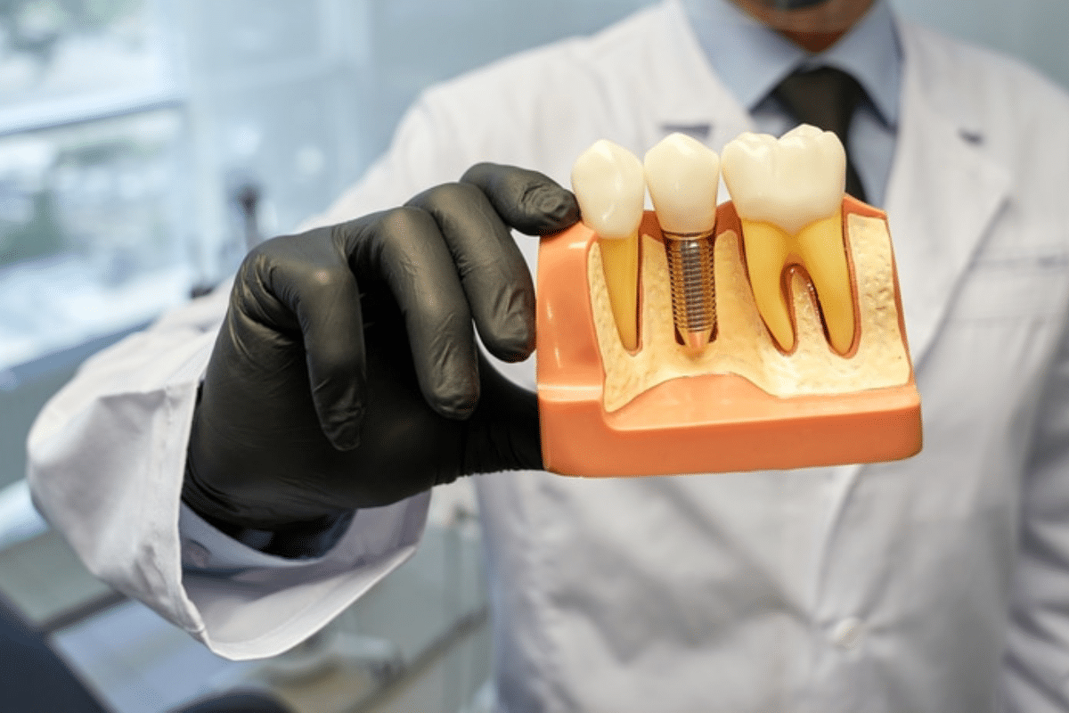 Prevent Infection After Dental Implants with Tips from Shreveport Dentist