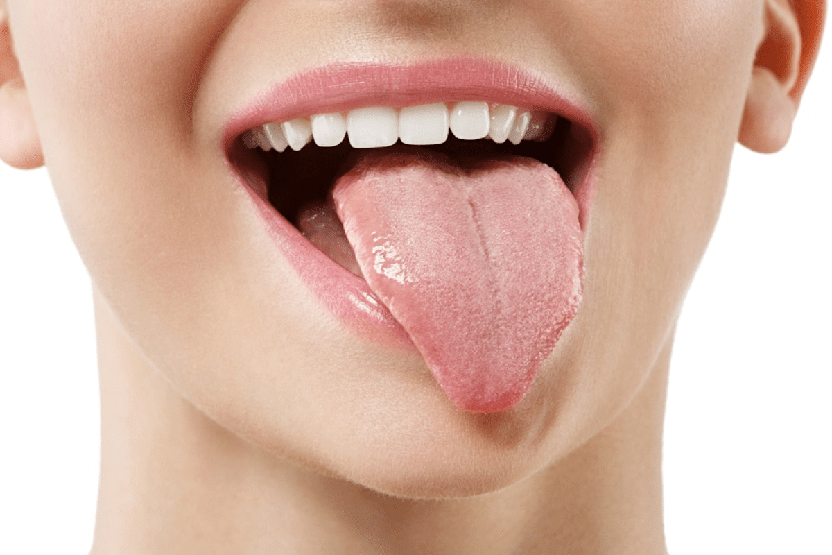 How to Care for Your Tongue? Know from our Dentist in Shreveport, LA