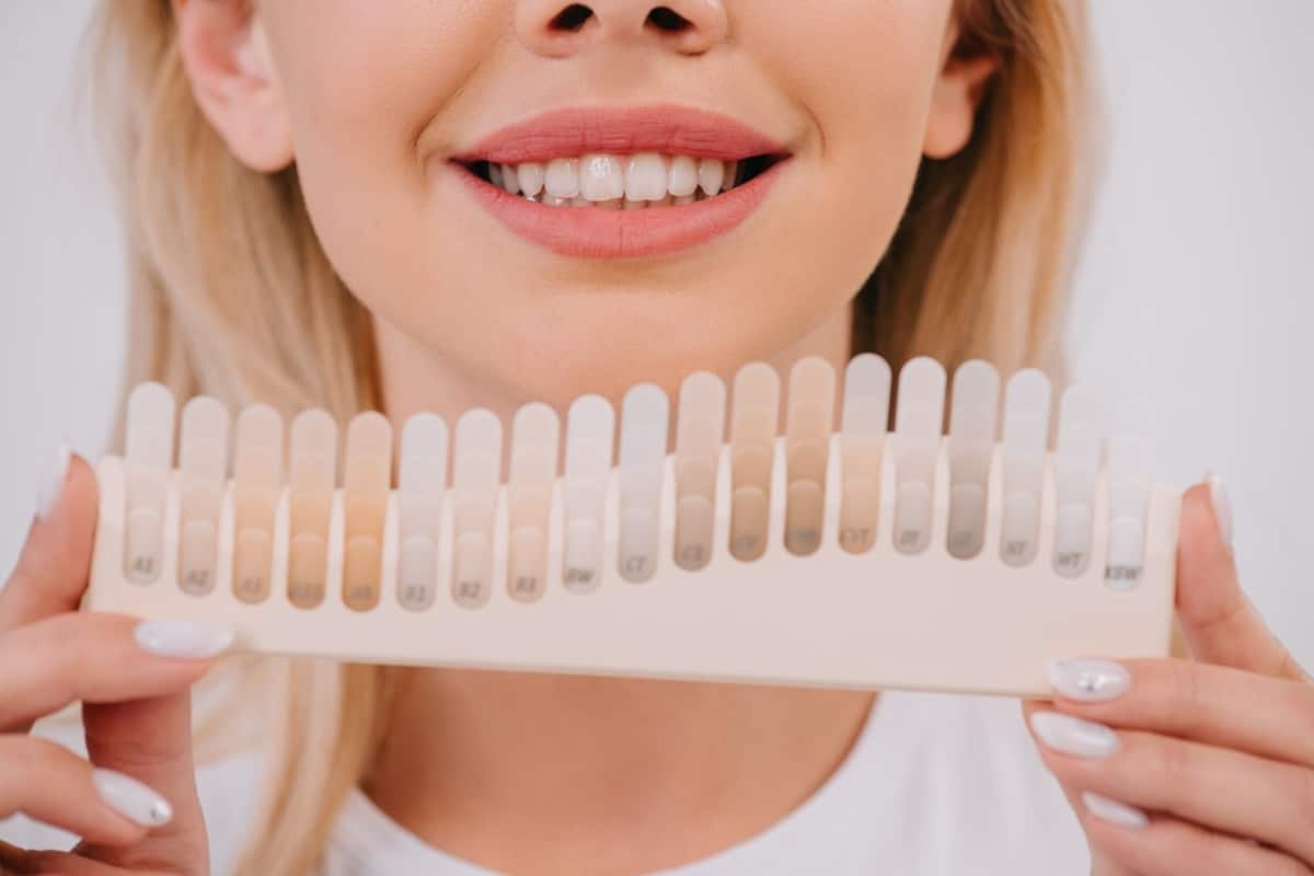 Make your Teeth Whitening in Shreveport Results Last Longer