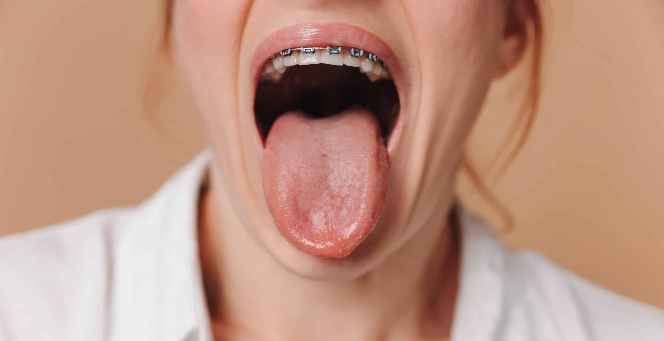dentist in shreveport explain tongue soreness after dental work